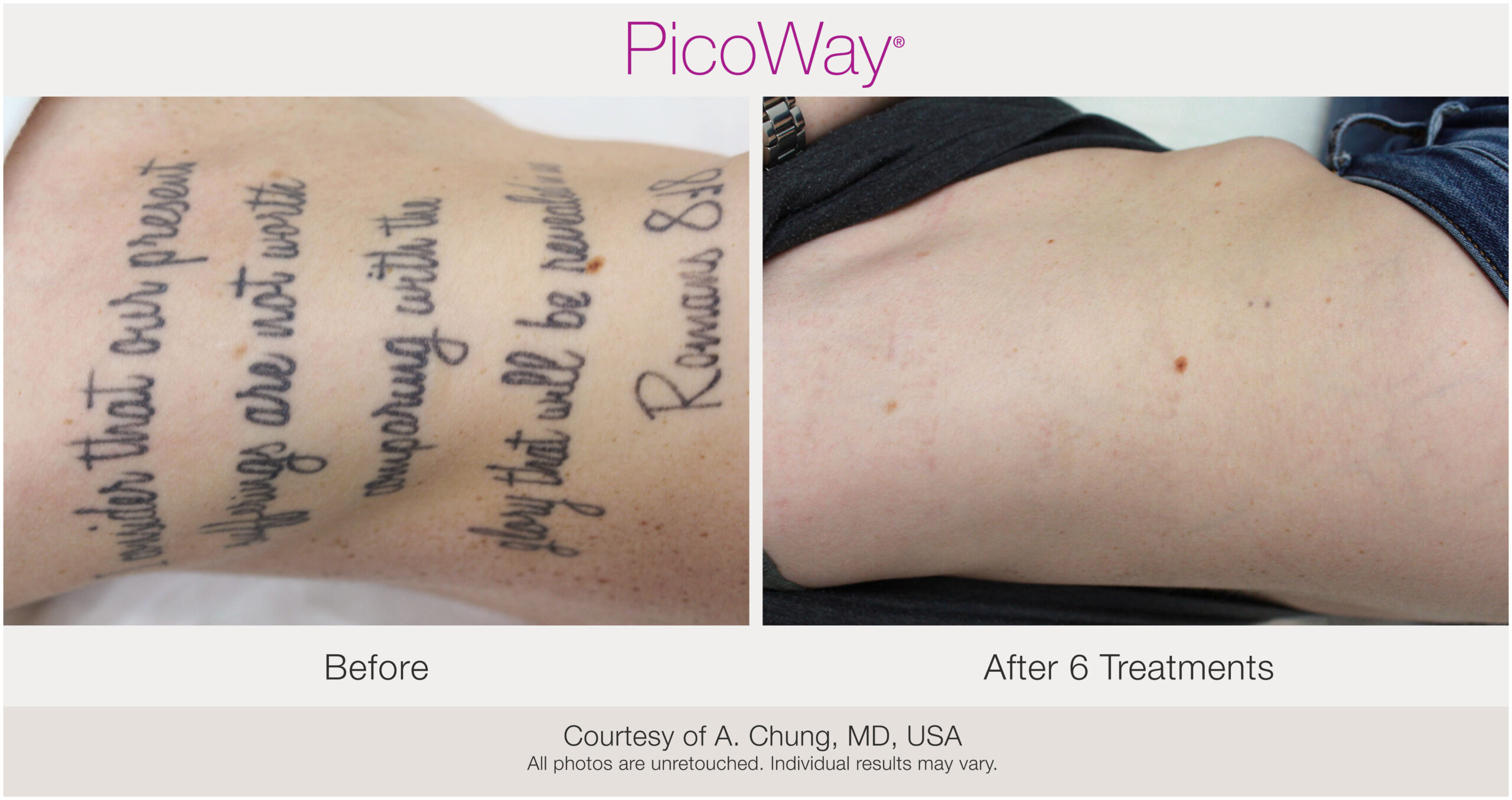Picoway Before & After