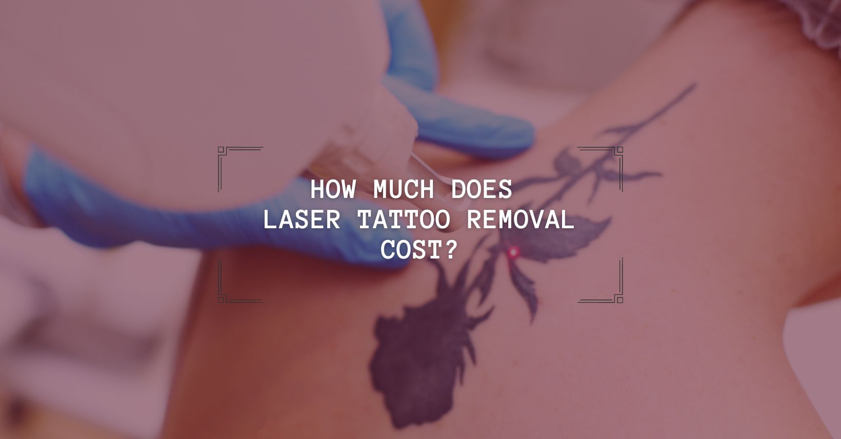How much does laser tattoo removal cost